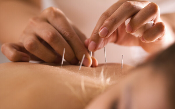 Hoe word ik acupuncturist in 5 stappen?